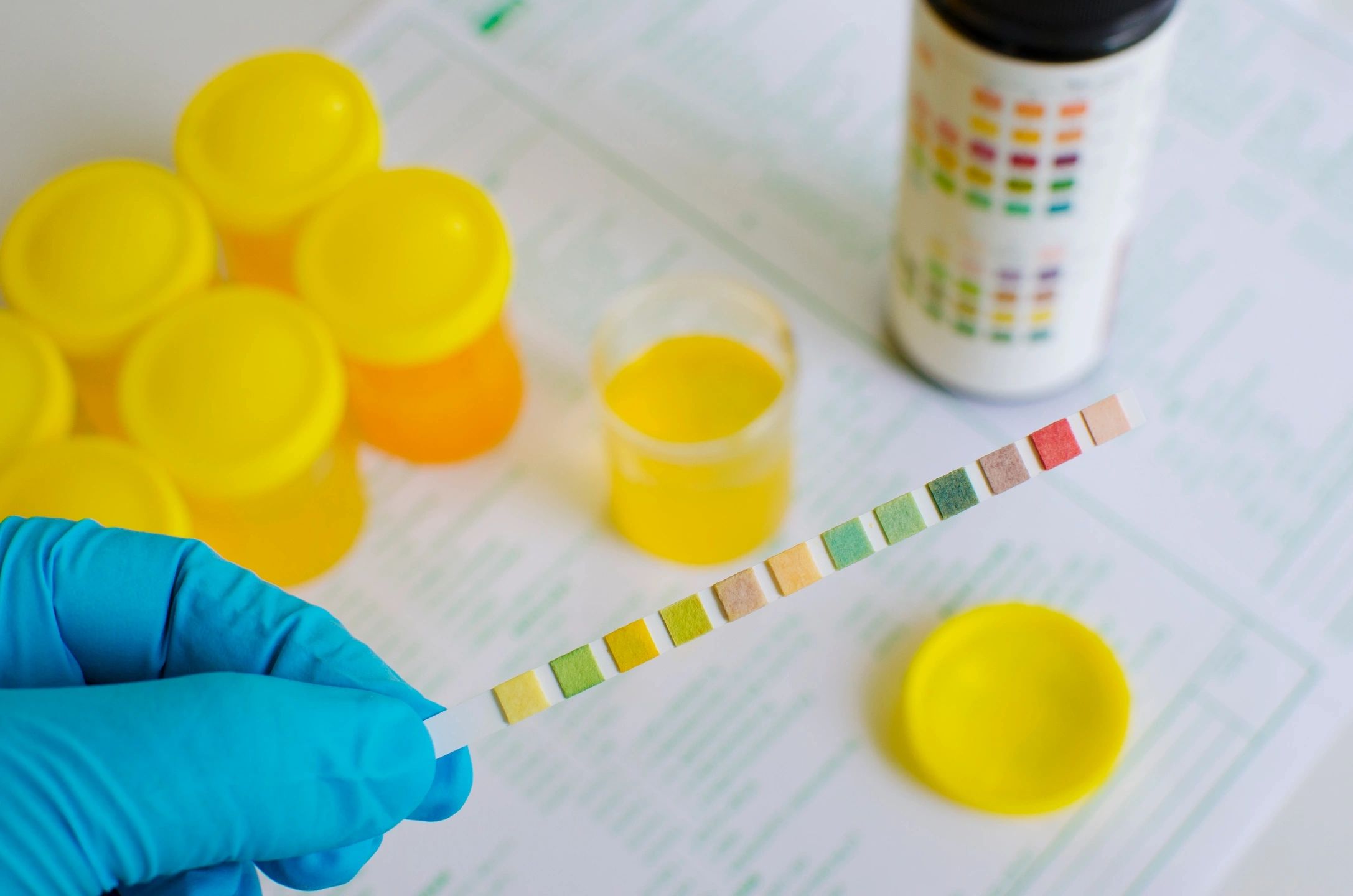 A close-up of a urine drug test kit with a sample container. This is a common method for drug screening and detection.